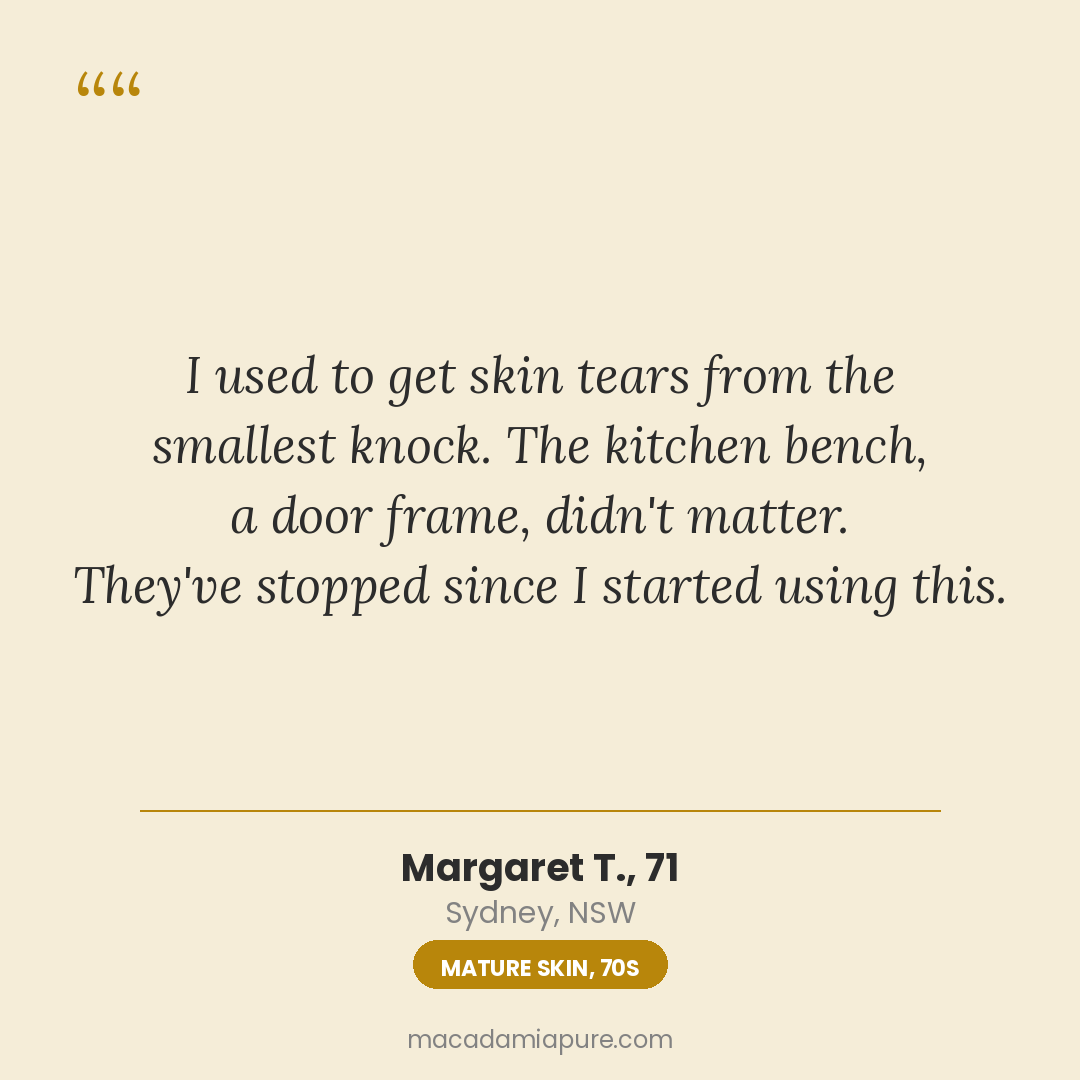 Margaret T., 71 - Mature skin